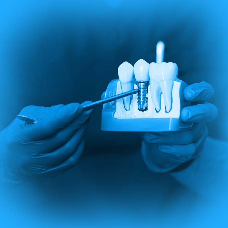 Curso: Especialização em Implantodontia — Especialização