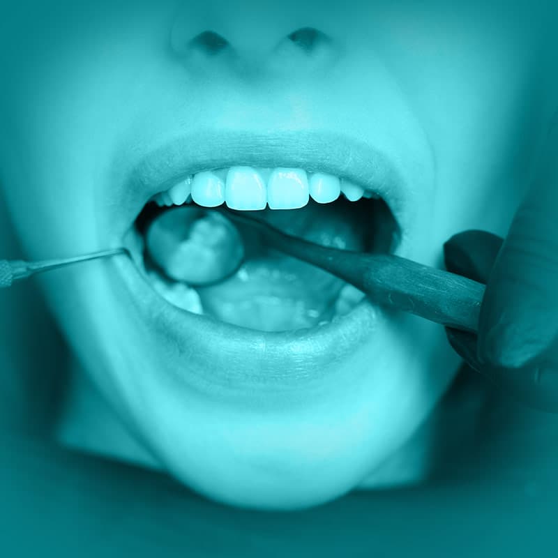 Curso: Reabilitação em Dentes Decíduos — Imersão