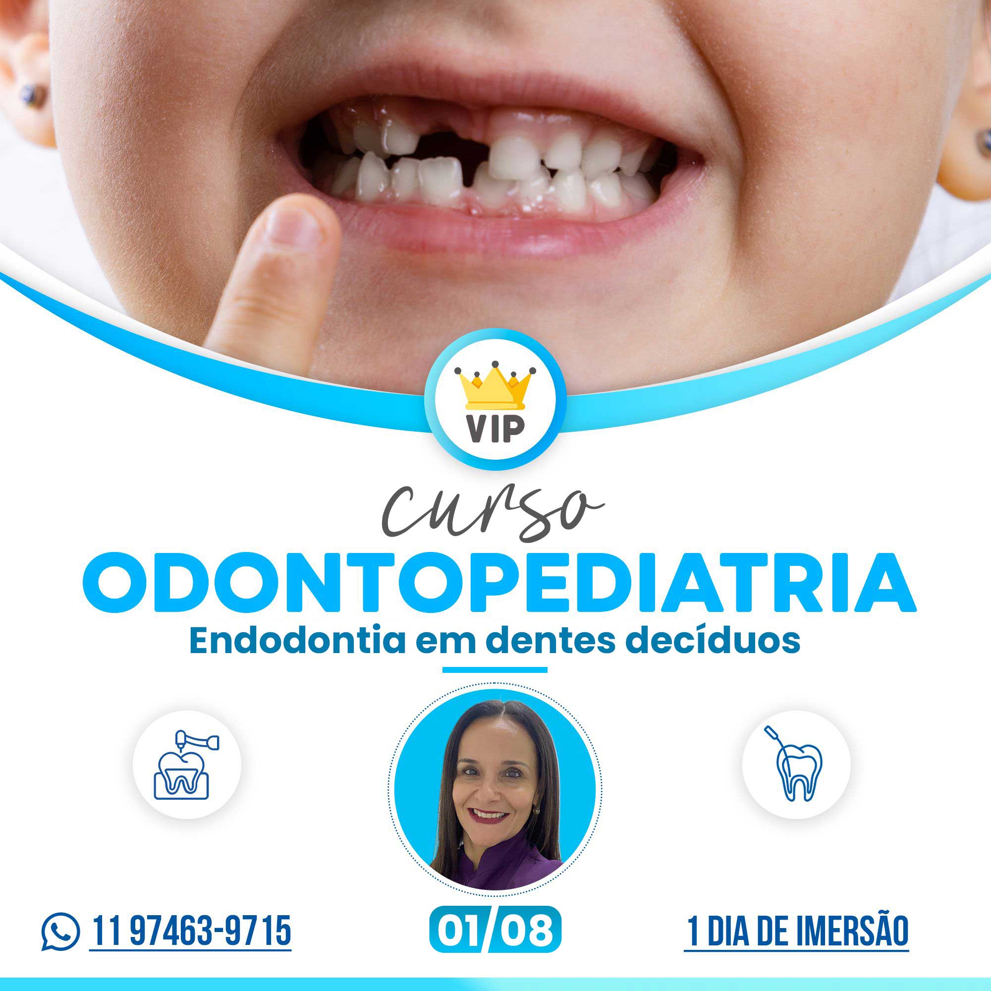 Odontopediatria VIP - Endodontia em dentes decíduos