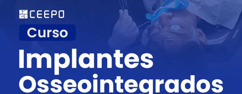 atualizacao-implantes-osseointegrados