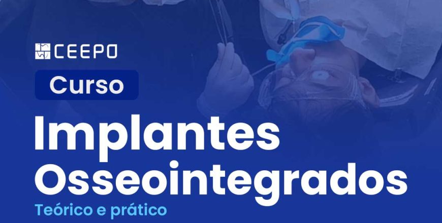 atualizacao-implantes-osseointegrados