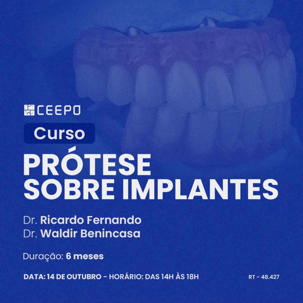 atualização-prótese-sobre-implantes