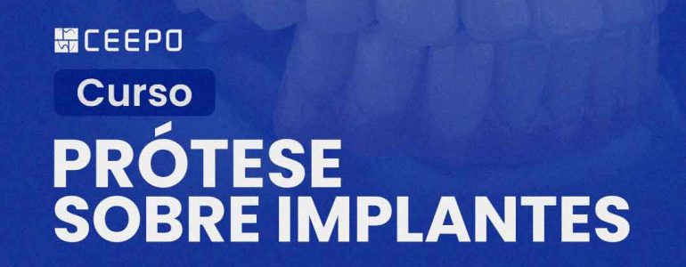 atualização-prótese-sobre-implantes