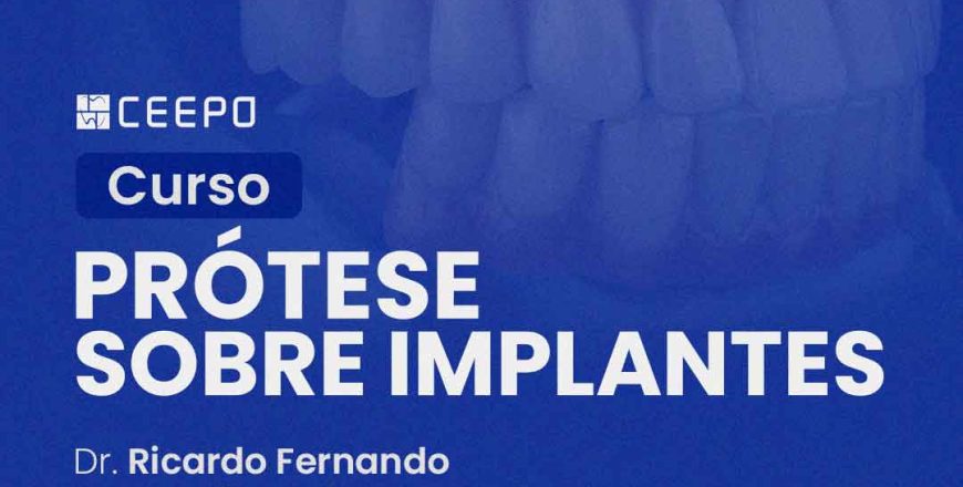 atualização-prótese-sobre-implantes