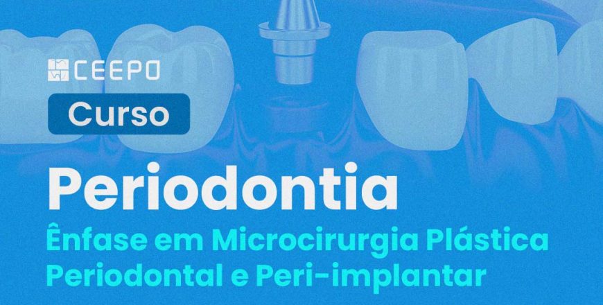 Aperfeiçoamento Periodontia