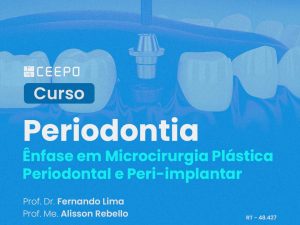 Aperfeiçoamento Periodontia