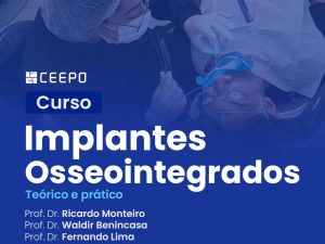 atualizacao-implantes-osseointegrados