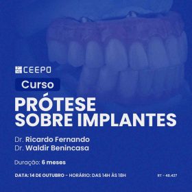 atualização-prótese-sobre-implantes