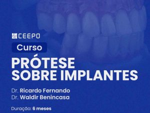 atualização-prótese-sobre-implantes